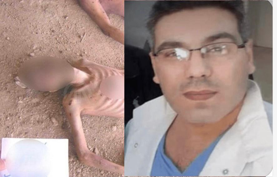صورة الطبيب المتهم علاء موسى وضحايا سجون الأسد في سوريا(انترنت)